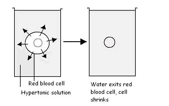 Image:Osmosis- red blood cell in hypertonic soliution.JPG